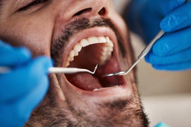 Best Urgent Tooth Repair  in Winfield, KS